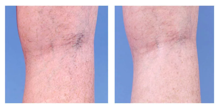 Kosmetische Korrektur